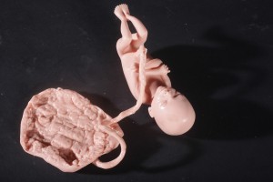 5_mo_fetus_29__76520_zoom