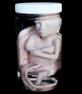 fetus_replica_5_months_in_jar_100_62__29567_zoom